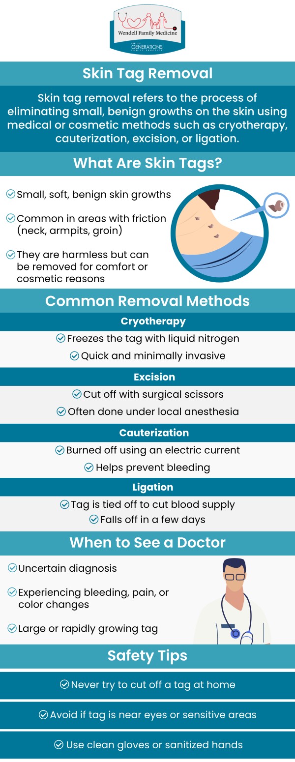 At Wendell Family Medicine in Wendell, NC, we offer expert skin tag removal services to help you achieve smoother, healthier skin. Our team provides safe and effective treatments to remove unwanted skin tags, using advanced techniques that minimize discomfort and promote quick healing. Whether you're seeking to address cosmetic concerns or remove bothersome skin tags, we deliver personalized care to meet your needs and enhance your confidence. For more information, contact us today or book an appointment online. We are conveniently located at 2839 Wendell Blvd Suite 100, Wendell, NC 27591. At Wendell Family Medicine in Wendell, NC, we offer expert skin tag removal services to help you achieve smoother, healthier skin. Our team provides safe and effective treatments to remove unwanted skin tags, using advanced techniques that minimize discomfort and promote quick healing. Whether you're seeking to address cosmetic concerns or remove bothersome skin tags, we deliver personalized care to meet your needs and enhance your confidence. For more information, contact us today or book an appointment online. We are conveniently located at 2839 Wendell Blvd Suite 100, Wendell, NC 27591.