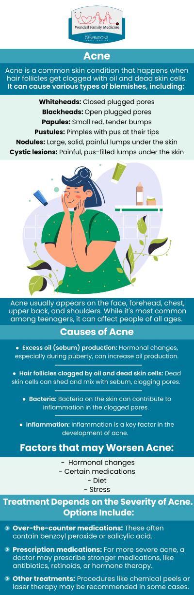 Struggling with persistent acne can affect both your skin and your confidence—but expert help is available. At Wendell Family Medicine, our acne specialists, Dr. Anna Marie Duncan, DO, and Dr. Lisa A. Bledsoe, MD, provide personalized treatment plans tailored to your skin’s unique needs. From hormonal breakouts to chronic adult acne, we use evidence-based solutions to target the root causes and promote clear, healthy skin. For more information, contact us or book an appointment online. We are located at 2839 Wendell Blvd Suite 100, Wendell, NC 27591. Struggling with persistent acne can affect both your skin and your confidence—but expert help is available. At Wendell Family Medicine, our acne specialists, Dr. Anna Marie Duncan, DO, and Dr. Lisa A. Bledsoe, MD, provide personalized treatment plans tailored to your skin’s unique needs. From hormonal breakouts to chronic adult acne, we use evidence-based solutions to target the root causes and promote clear, healthy skin. For more information, contact us or book an appointment online. We are located at 2839 Wendell Blvd Suite 100, Wendell, NC 27591.